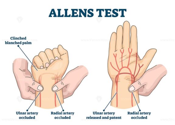 Allens test vector illustration
