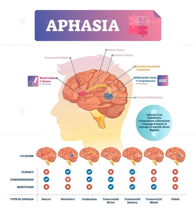 Aphasia vector illustration