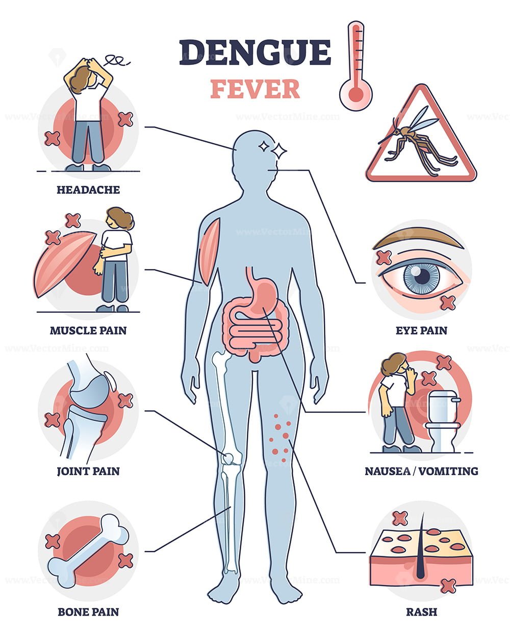 Dengue fever symptoms awareness poster, educational vector illustration  diagram – VectorMine