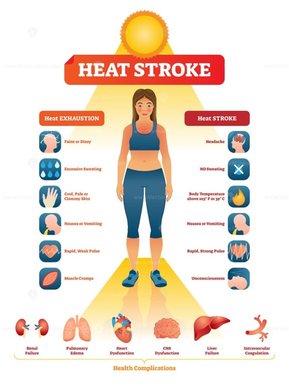 Heat stroke vector illustration