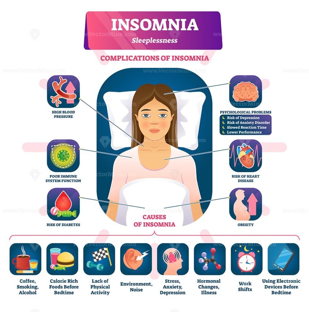 Инсомния что это. Инсомния инфографика. Инсомния части. Illustrations Insomnia causes. Psychological causes of Insomnia.