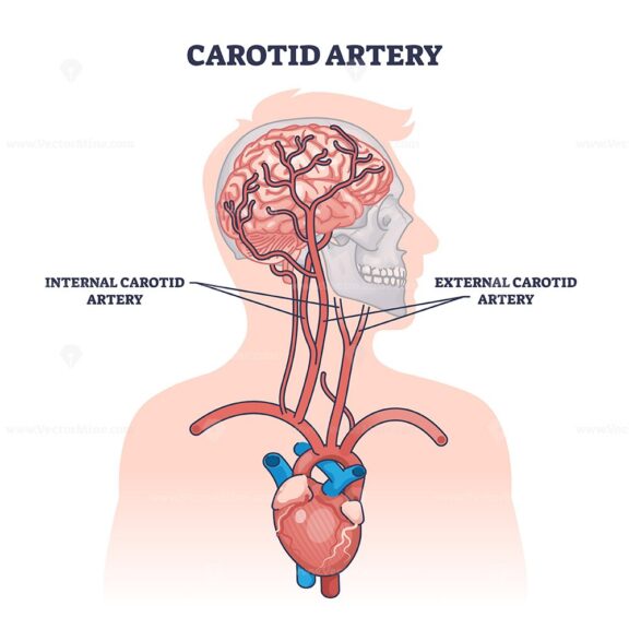Carotid artery as brain blood supply major vessels outline diagram