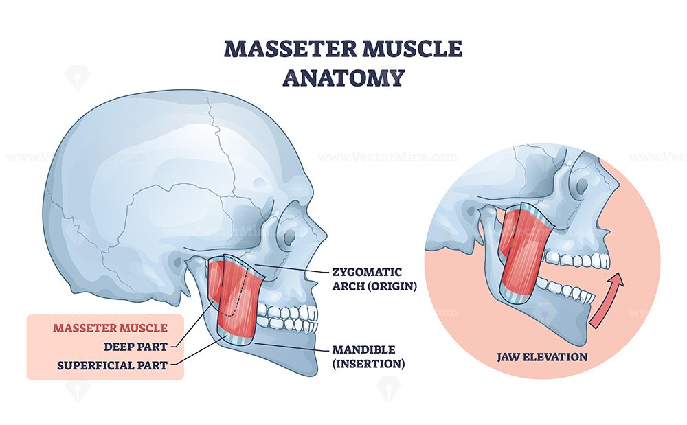Masseter anatomy, labeled masseter muscle linking zygomatic arch to mandible, illustrating jaw elevation and chewing function, key objects, masseter, skull, mandible. Outline diagram
