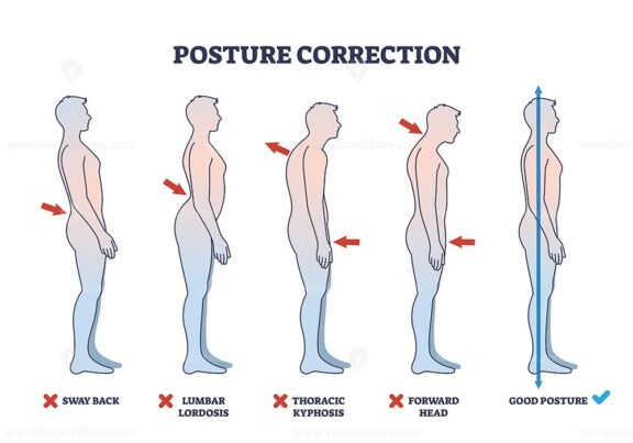 Posture correction diagram shows five side-view silhouettes ...