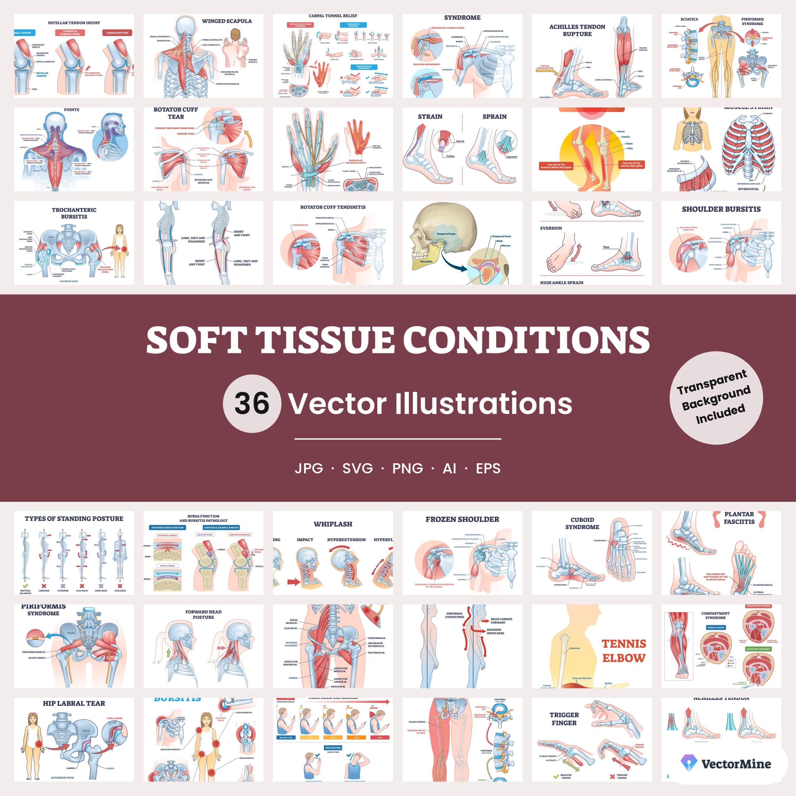Soft Tissue Conditions – Diagram Bundle