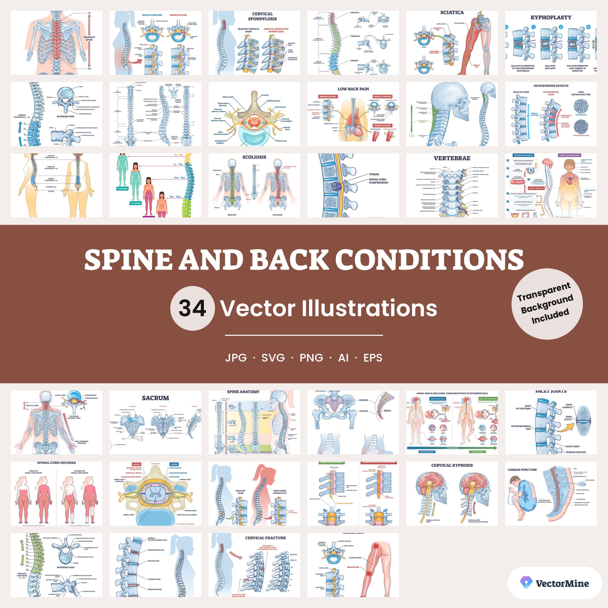 Spine and Back Conditions – Diagram Bundle