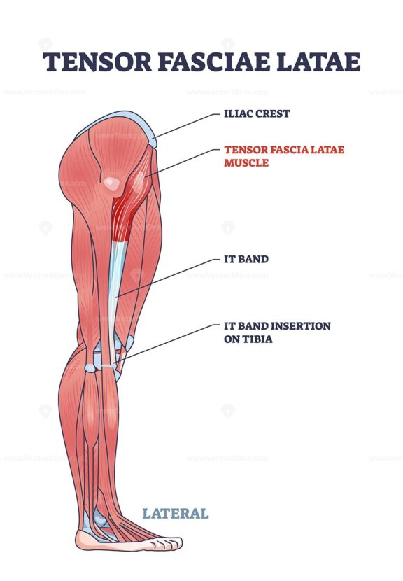 Medical illustration showing the Tensor Fasciae Latae muscle, IT band, and iliac crest, diagram.